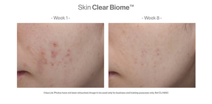 Advanced Nutrition Programme - Skin Clear Biome