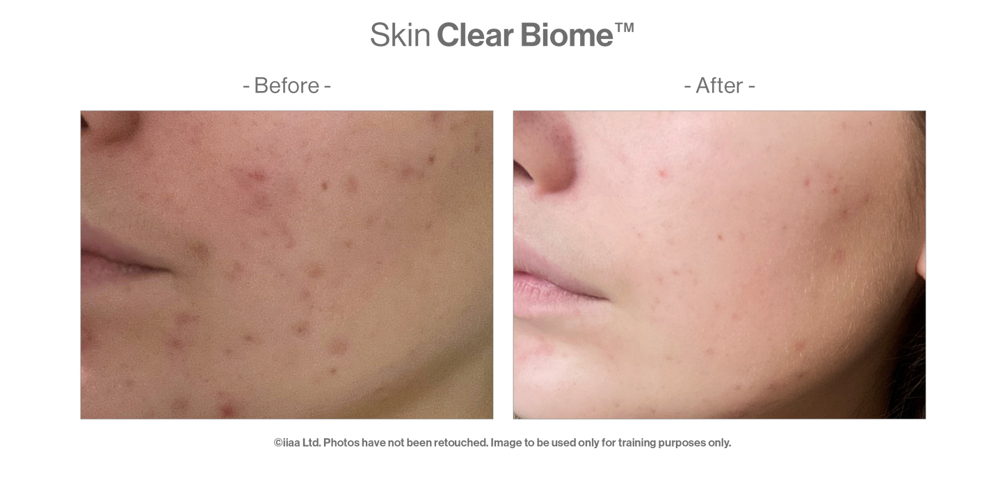 Advanced Nutrition Programme - Skin Clear Biome