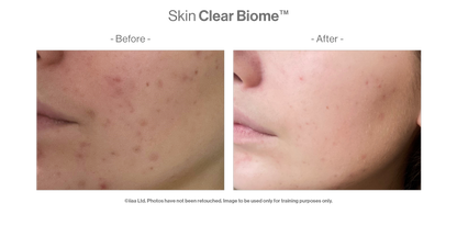 Advanced Nutrition Programme - Skin Clear Biome