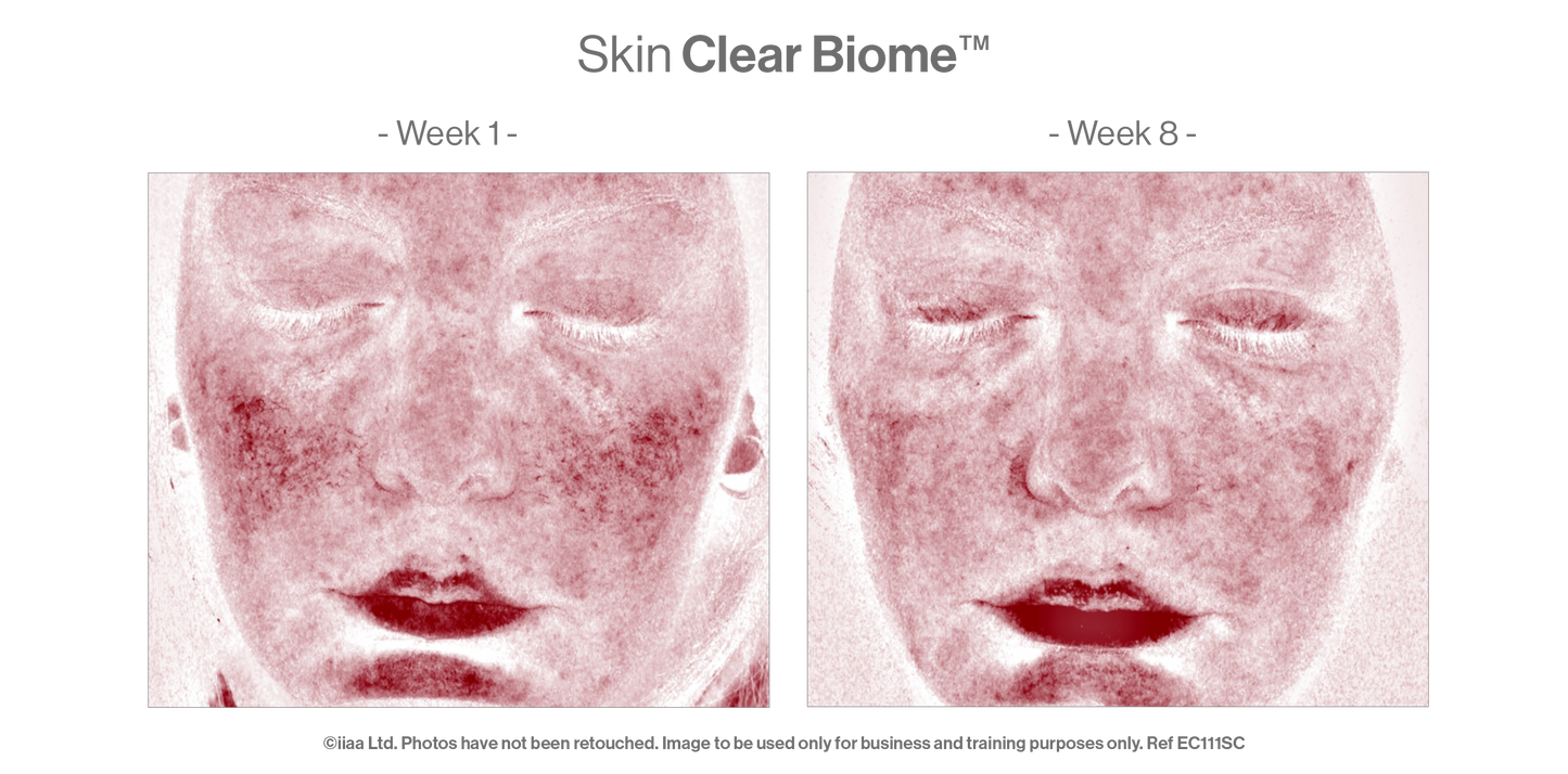 Advanced Nutrition Programme - Skin Clear Biome