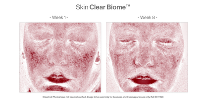 Advanced Nutrition Programme - Skin Clear Biome