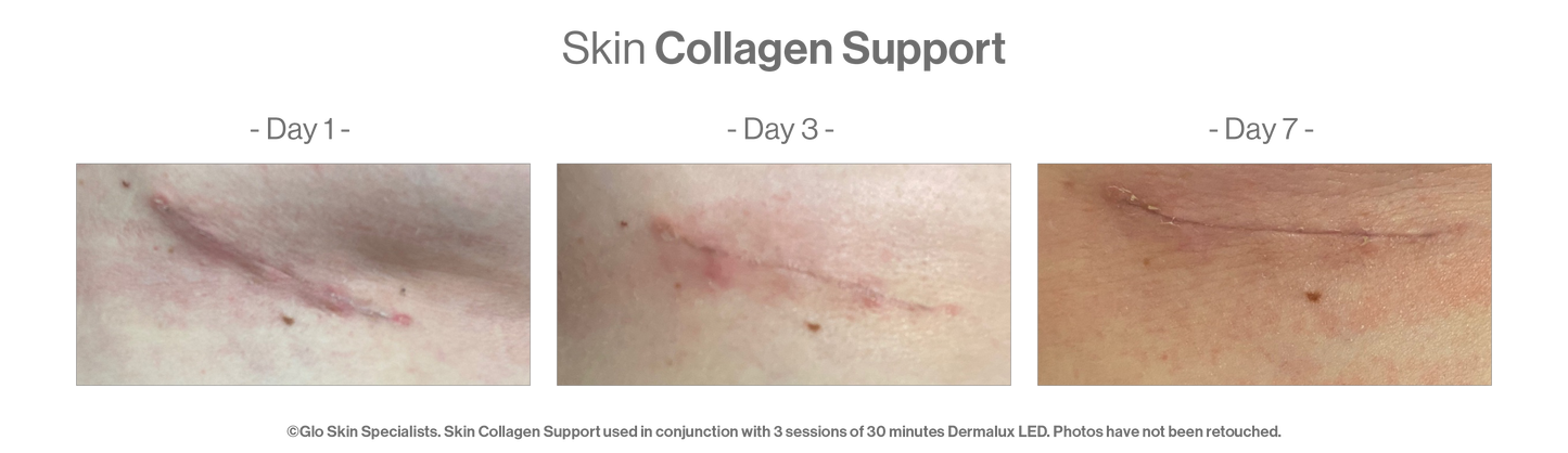 Advanced Nutrition Programme - Skin Collagen Support