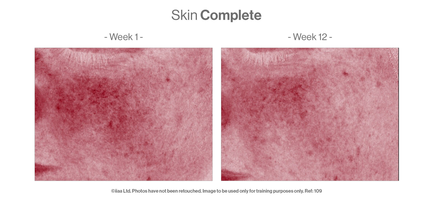 Advanced Nutrition Programme - Skin Complete