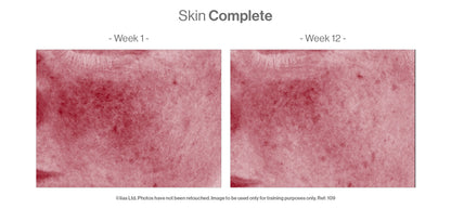 Advanced Nutrition Programme - Skin Complete