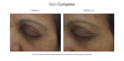Advanced Nutrition Programme - Skin Complete