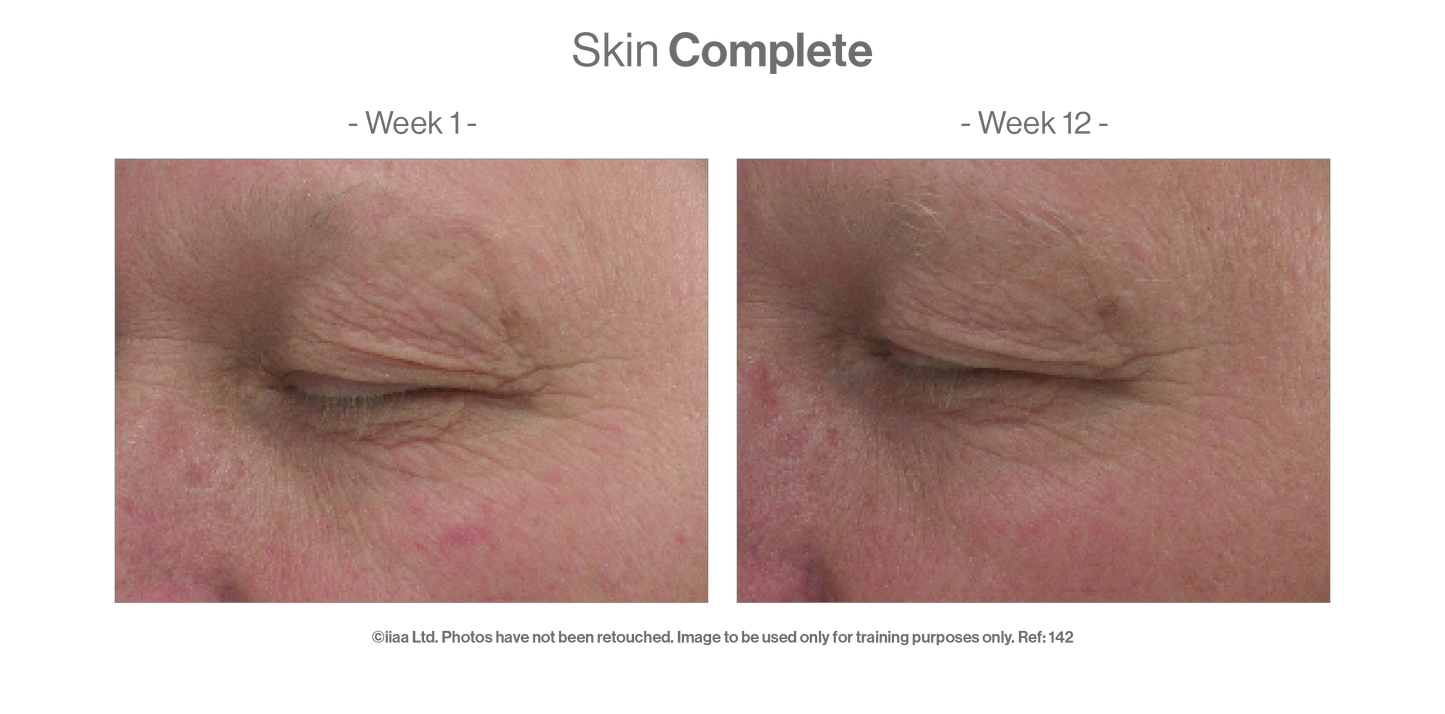 Advanced Nutrition Programme - Skin Complete