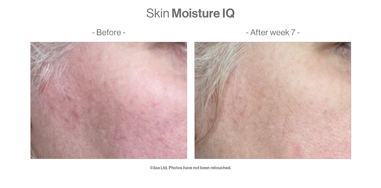 Advanced Nutrition Programme - Skin Moisture IQ