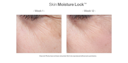 Advanced Nutrition Programme - Skin Moisture Lock