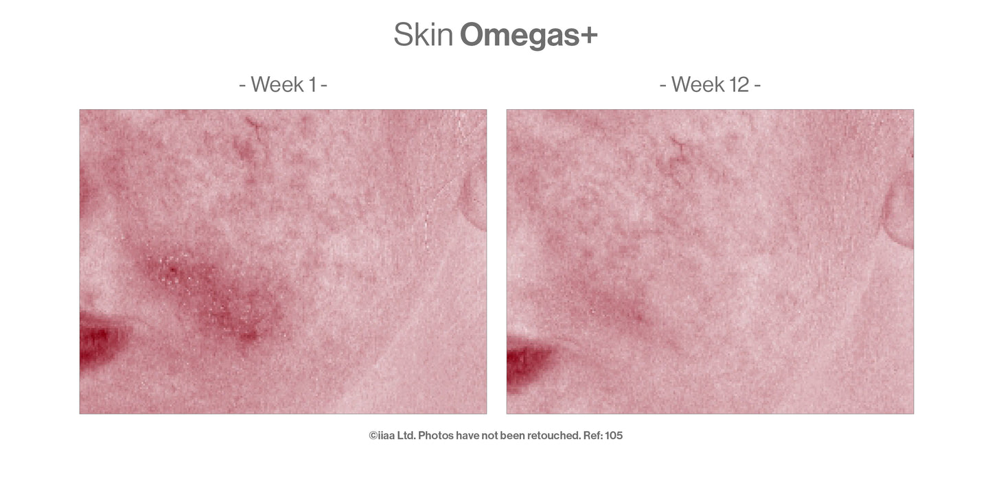 Advanced Nutrition Programme - Skin Omegas+