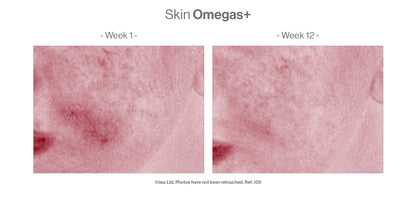 Advanced Nutrition Programme - Skin Omegas+