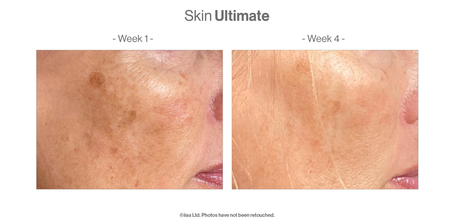 Advanced Nutrition Programme - Skin Ultimate