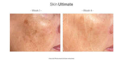 Advanced Nutrition Programme - Skin Ultimate