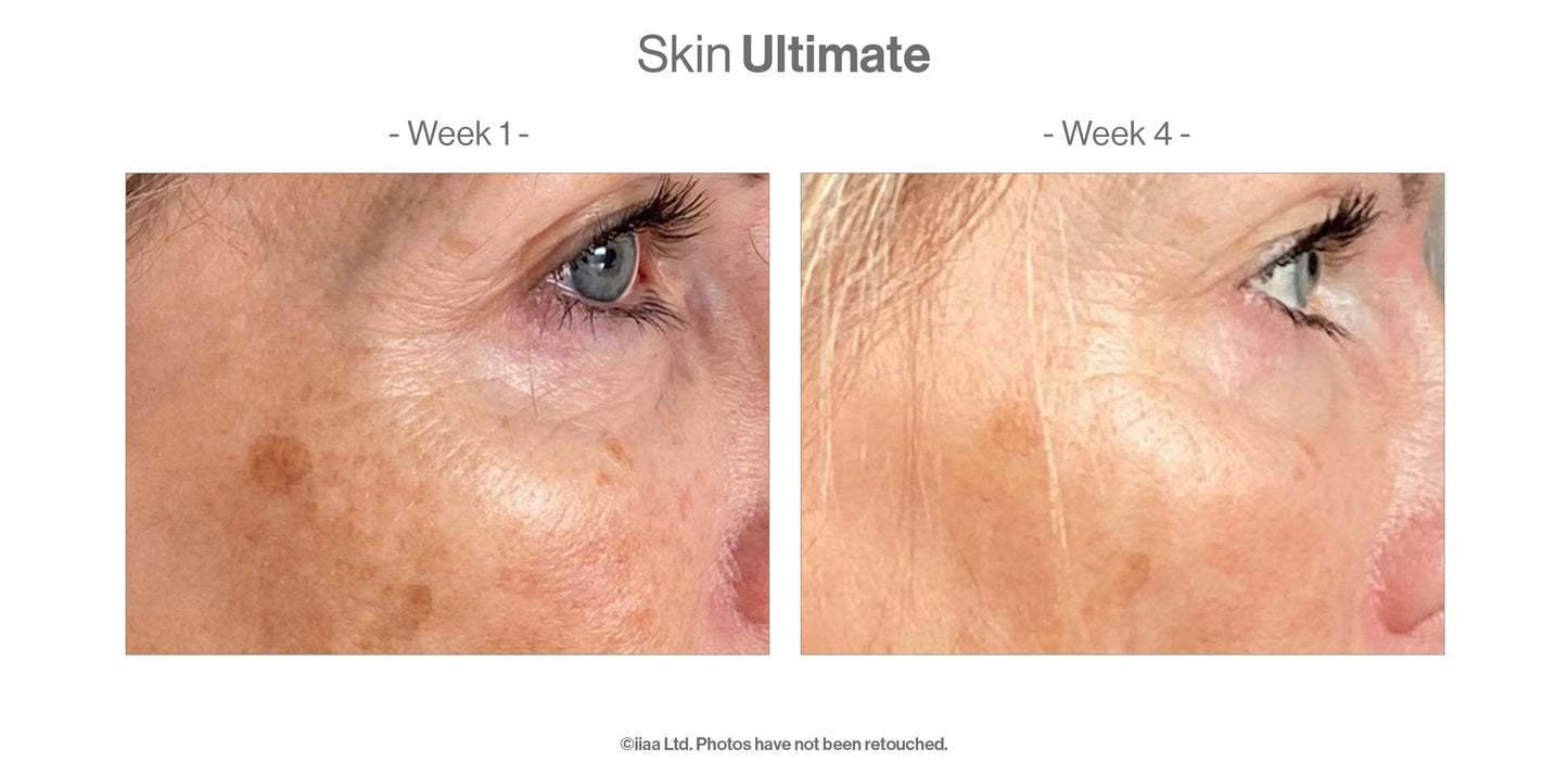 Advanced Nutrition Programme - Skin Ultimate