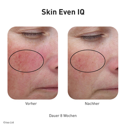 Advanced Nutrition Programme - Skin Even IQ